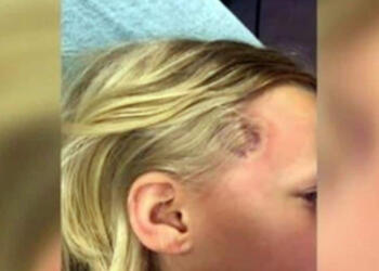 7χρονη ανέβασε πυρετό αλλά οι γιατροί την έστειλα σπίτι – Λίγο αργότερα αποδείχθηκε μοιραίο λάθος