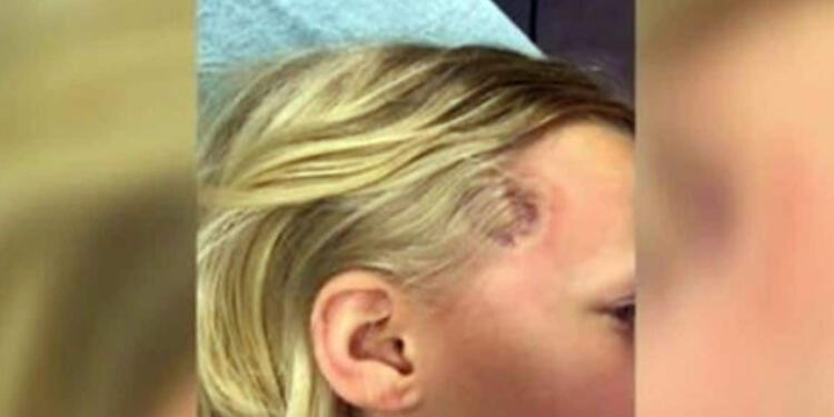 7χρονη ανέβασε πυρετό αλλά οι γιατροί την έστειλα σπίτι – Λίγο αργότερα αποδείχθηκε μοιραίο λάθος