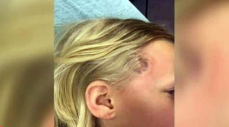 7χρονη ανέβασε πυρετό αλλά οι γιατροί την έστειλα σπίτι – Λίγο αργότερα αποδείχθηκε μοιραίο λάθος