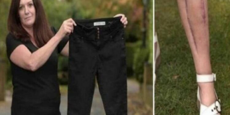 52χρονη χόρευε σε ένα πάρτι όταν λιποθύμησε ξαφνικά. Μόλις οι γιατροί πρόσεξαν λίγο καλύτερα το παντελόνι της. Πάγωσαν…