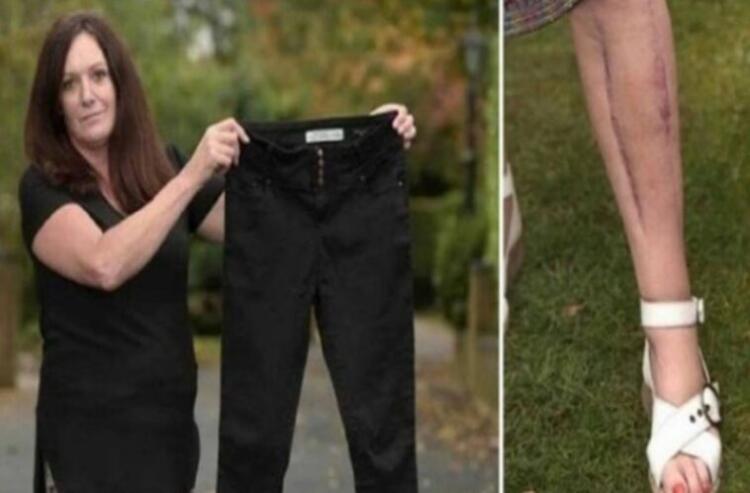 52χρονη χόρευε σε ένα πάρτι όταν λιποθύμησε ξαφνικά. Μόλις οι γιατροί πρόσεξαν λίγο καλύτερα το παντελόνι της. Πάγωσαν…