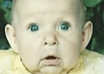 Το πρόσωπο αυτού του μωρού άλλαζε από μέρα σε μέρα – Μόλις οι γιατροί κατάλαβαν το γιατί…
