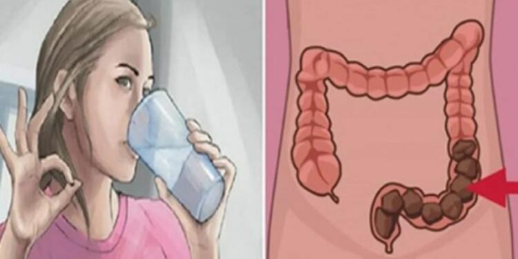 Ξεφούσκωμα Express: Αφαιρέστε 13 Κιλά Ακαθαρσιών από το Έντερό σας, με αυτή τη Σπιτική Συνταγή