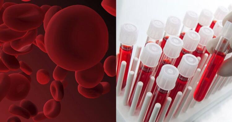 Γιατί οι άνθρωποι με ομάδα αίματος 0 είναι ξεχωριστοί;