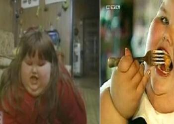 Η 8χρονη Έτρωγε ότι έβρισκε μπροστά της και έφτασε 190 κιλά. Σήμερα είναι Μόνο 40 και κανείς Δεν την γνωρίζει