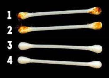 Κερί Στο Αυτί: Τι Δείχνει Για Την Υγεία Σας!