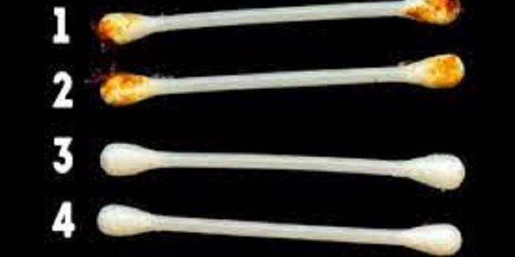 Κερί Στο Αυτί: Τι Δείχνει Για Την Υγεία Σας!