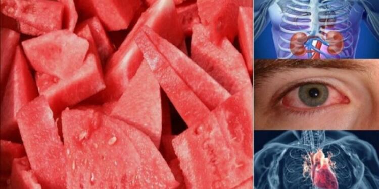 Δείτε τι θα συμβεί στο σώμα σας αν τρώτε μια φέτα καρπούζι κάθε μέρα για μια εβδομάδα! Απίστευτο!