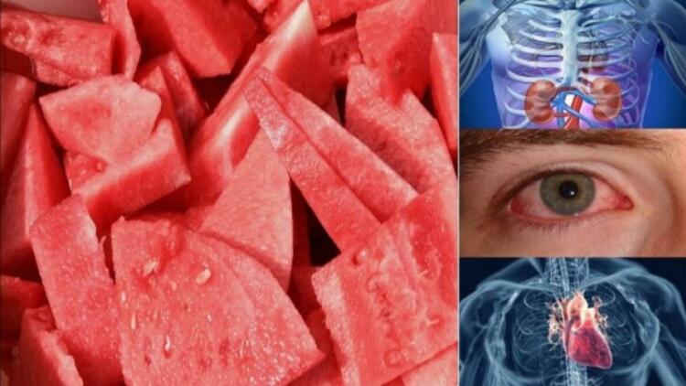 Δείτε τι θα συμβεί στο σώμα σας αν τρώτε μια φέτα καρπούζι κάθε μέρα για μια εβδομάδα! Απίστευτο!