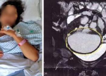 Έκανε έpωτa με το αγόρι της όταν ένιωσε μέσα της ένα περίεργο τράνταγμα. Μόλις την εξέτασε ο γιατρός ανακάλυψε κάτι σοκαριστικό