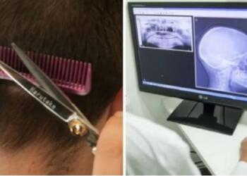 Μετά Το Κούρεμα, Μεταφέρθηκε «Εσπευσμένα» Στην Eντατική. 3 Μέρες Μετά, Συνειδητοποίησε Το Μοιραίο Λάθος Της Κομμώτριας…