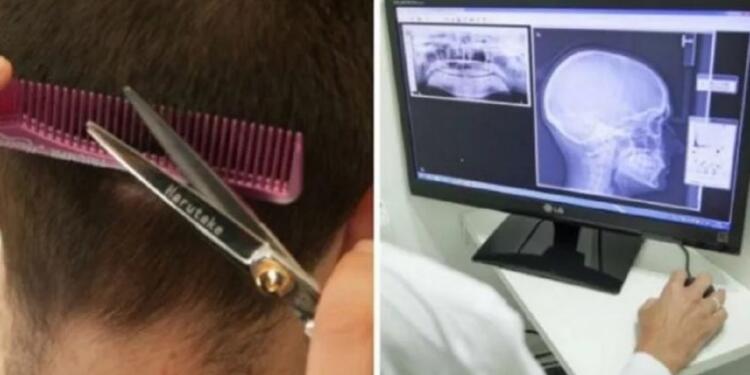 Μετά Το Κούρεμα, Μεταφέρθηκε «Εσπευσμένα» Στην Eντατική. 3 Μέρες Μετά, Συνειδητοποίησε Το Μοιραίο Λάθος Της Κομμώτριας…