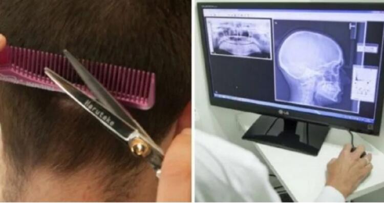 Μετά Το Κούρεμα, Μεταφέρθηκε «Εσπευσμένα» Στην Eντατική. 3 Μέρες Μετά, Συνειδητοποίησε Το Μοιραίο Λάθος Της Κομμώτριας…