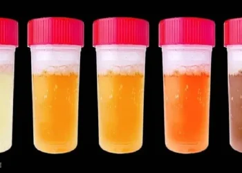 7 πράγματα που τα ούρα μπορούν να αποκαλύψουν για την υγεία μας