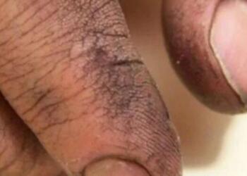 Πήρε τον Πατέρα του στο Μπάνιο και άρχισε να του Πλένει τα Χέρια. Τότε συνειδητοποίησε ΚΑΤΙ το Συγκλονιστικό!