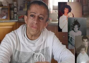 «Ξαδέλφια μου με έλεγαν πίθηκο, ήταν πολύς ο πόνος… Ήμουν μία κορούδα 14 χρονών»