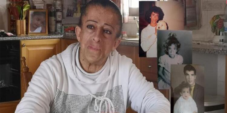 «Ξαδέλφια μου με έλεγαν πίθηκο, ήταν πολύς ο πόνος… Ήμουν μία κορούδα 14 χρονών»