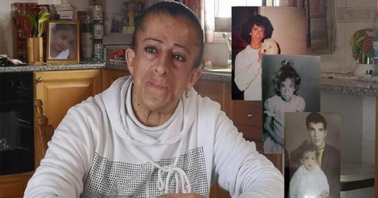 «Ξαδέλφια μου με έλεγαν πίθηκο, ήταν πολύς ο πόνος… Ήμουν μία κορούδα 14 χρονών»