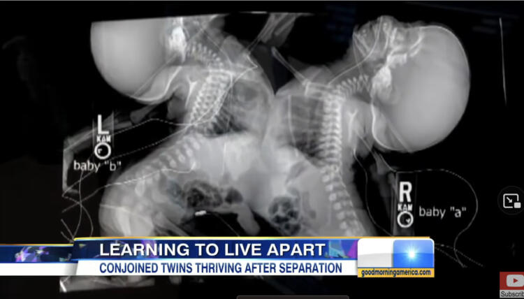 27χρονη έγκυος πήγε να κάνει υπερηχογράφημα – Όταν το είδαν οι γιατροί πάγωσαν και της είπαν..