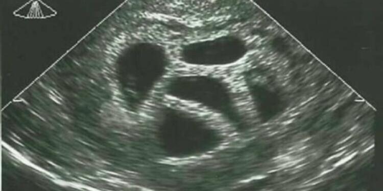 Μια έγκυος γυναίκα αγνόησε τις συμβουλές του γιατρού να κάνει έκτρωση… 20 χρόνια αργότερα δημοσιεύει αυτό!