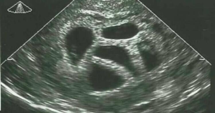 Μια έγκυος γυναίκα αγνόησε τις συμβουλές του γιατρού να κάνει έκτρωση… 20 χρόνια αργότερα δημοσιεύει αυτό!