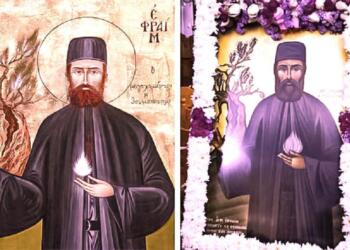 Δοξασμένο το όνομα του Αγίου Εφραίμ! Ο γιατρός είπε ότι δεν υπάρχει ίχνος ελκοπάθειας