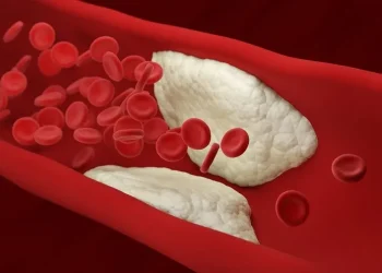 Φραγμένες αρτηρίες: Αυτές είναι οι 12 απαγορευμένες τροφές