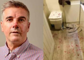 Ήρωας πατέρας «κομματιάστηκε» αλλά έσωσε την κόρη του από 5 βιαστές με ματσέτες και μαχαίρια