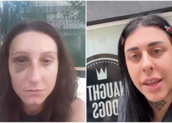 Σούπερ Κική: «Θα το ξαναέκανα και θα το ξανακάνω» – Στην δημοσιοτητα οι φωτογραφίες της κακοποιημένης φίλης της