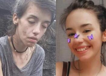 «Είμαι 9 μήνες καθαρή. Πάλεψα σκληρά και μοιράζομαι την ιστορία μου γιατί είναι σημαντικό να σου πω ότι μπορείς»