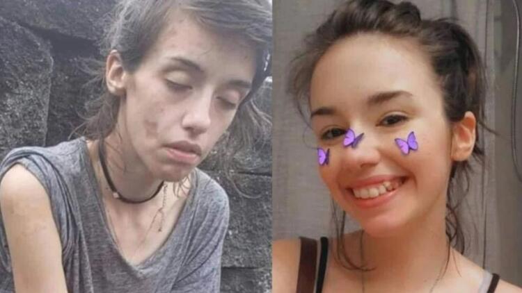 «Είμαι 9 μήνες καθαρή. Πάλεψα σκληρά και μοιράζομαι την ιστορία μου γιατί είναι σημαντικό να σου πω ότι μπορείς»