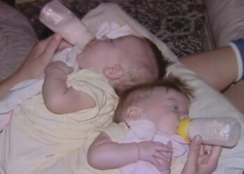 19 Χρόνια Πριν τους Είπαν να Μην Κάνουν την Εγχείριση. Αυτοί Δεν Άκουσαν και Ιδού τα Αποτελέσματα.