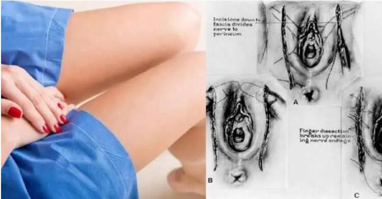 Οι Γιατροί Προειδοποιούν. Δείτε ΤΙ Συμβαίνει στον Γυναικείο Κόλπο όταν «Πιάνει μούχλα 🙄»