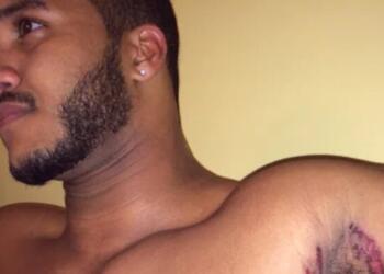 Εκεί που έκανε μπάνιο, ένιωσε κάτι να τον καίει κάτω από τη μασχάλη. Δεν ήταν όμως το σαπούνi ήταν κάτι ΧΕΙΡΟΤΕΡΟ…