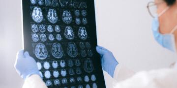 A Doctor Holding an MRI Result of the Brain