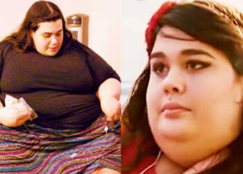 Δεν την αναγνωρίζει κανείς: Η «παχύτερη γυναίκα στον κόσμο» ζύγιζε 300 κιλά, έχασε τα 180 και πλέον είναι μια κούκλα