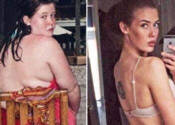 Μια παχύσαρκη μαθήτρια έχασε το μισό της βάρος χρησιμοποιώντας μόνο ένα κουταλάκι του γλυκού… και σήμερα είναι μοντέλο