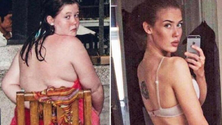 Μια παχύσαρκη μαθήτρια έχασε το μισό της βάρος χρησιμοποιώντας μόνο ένα κουταλάκι του γλυκού… και σήμερα είναι μοντέλο