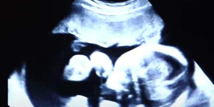 52χρονη είναι έγκυος στα δίδυμα παιδιά του γαμπρού της – Όταν όμως οι γιατροί είδαν τον τελευταίο υπέρηχο «πάγωσαν» (Video)