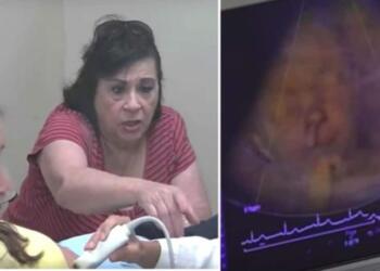 Πήγε για υπερηχογράφημα την έγκυο ανιψιά της – Μόλις όμως κοίταξε την oθόνη έπαθε το σοκ της ζωής της (Video)