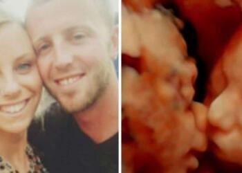 24χρονη έγκυος πήγε για υπερηχογράφημα – Μόλις κοίταξε την οθόνη πάγωσε