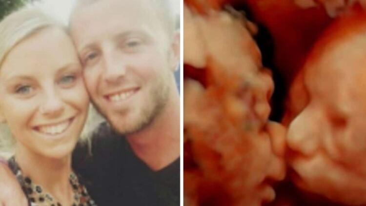 24χρονη έγκυος πήγε για υπερηχογράφημα – Μόλις κοίταξε την οθόνη πάγωσε