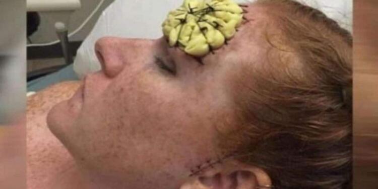 39χρονη έμεινε έγκυος και φύτρωσε στο μέτωπό της κάτι παράξενο – Μόλις της το αφαίρεσαν οι γιατροί «πάγωσαν»