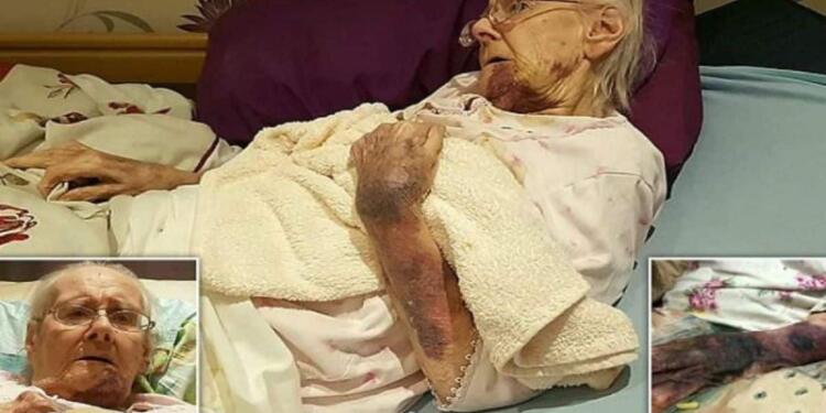 98χρονη γιαγιά είχε γεμίσει με μελανιές – Όταν ο εγγονός της κατάλαβε ποιος της το έκανε…