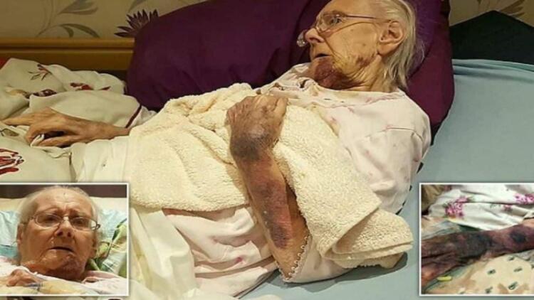 98χρονη γιαγιά είχε γεμίσει με μελανιές – Όταν ο εγγονός της κατάλαβε ποιος της το έκανε…