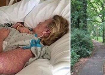 56χρονη μητέρα πήγε στο νοσοκομείο γεμάτη σπυράκια στο σώμα αλλά ήταν αργά – Δεν φαντάζεστε από τι πέθανε