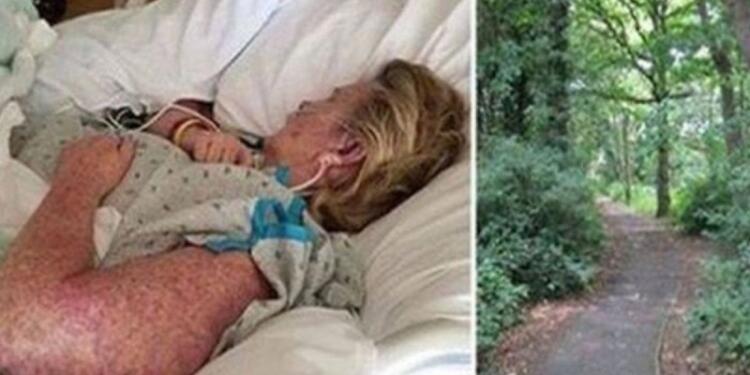 56χρονη μητέρα πήγε στο νοσοκομείο γεμάτη σπυράκια στο σώμα αλλά ήταν αργά – Δεν φαντάζεστε από τι πέθανε