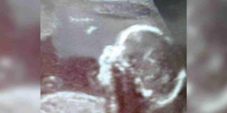 Έγκυος γυναίκα πήγε να δει τον υπέρηχο του μωρού της – Αυτό το που αντίκρισε στην γέννα θα σας σοκάρει