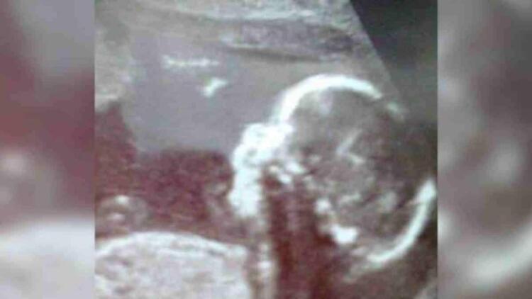 Έγκυος γυναίκα πήγε να δει τον υπέρηχο του μωρού της – Αυτό το που αντίκρισε στην γέννα θα σας σοκάρει