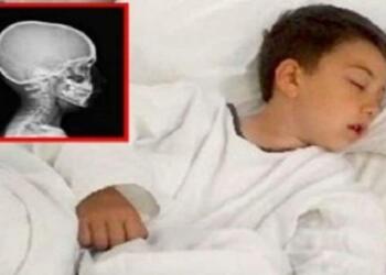 Έψησε ένα μπιφτέκι να φάει ο γιος της που πεινούσε! Λίγη ώρα αργότερα, έτρεχαν στα επείγοντα…